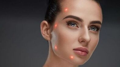 Qu'est-ce que le rajeunissement fractionné de la peau