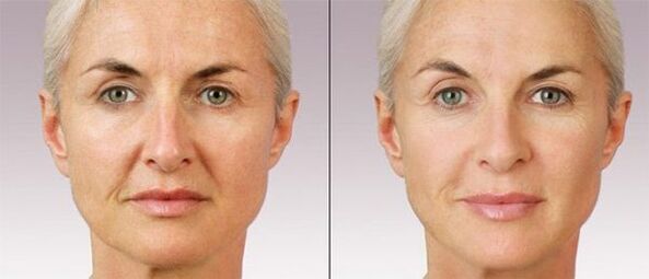 contour en plastique