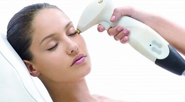 Comment se déroule le rajeunissement fractionné de la peau