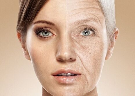 avant et après le rajeunissement de la peau du visage au laser