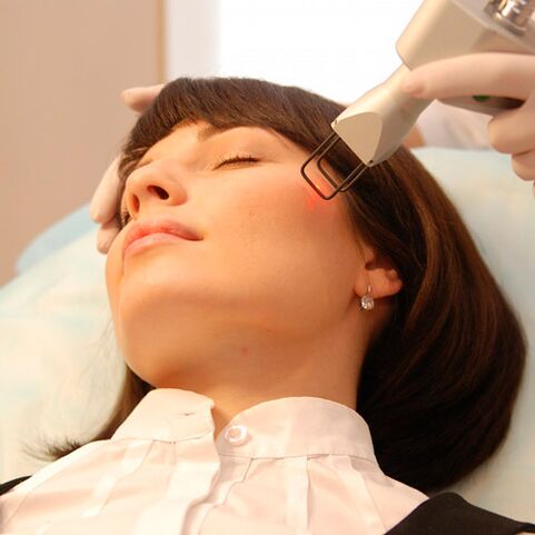 Rajeunissement fractionné au laser de la peau du visage