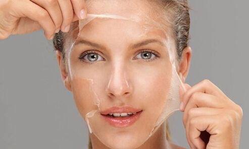 Un peeling profond favorise les processus de régénération de la peau et la rajeunit